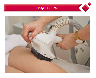 הצרת היקפים